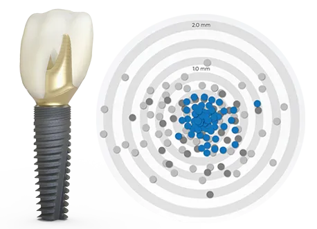 implanturi dentare certificate clinica dentara maxilomed oradea